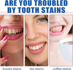 Sp-4 probiotic whitening toothpaste, Teeth Whitener Toothpaste (PACK OF 2)